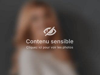 Comment entretenir une facette dentaire ? Chirurgie maxillo-faciale Avant et après - Multiesthetique.fr