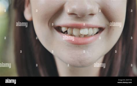 A Teenage Girl Demonstrates Her Crooked Teeth Stock Photo Alamy