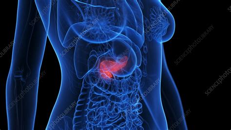 Inflamed Pancreas Illustration Stock Image F0384388 Science