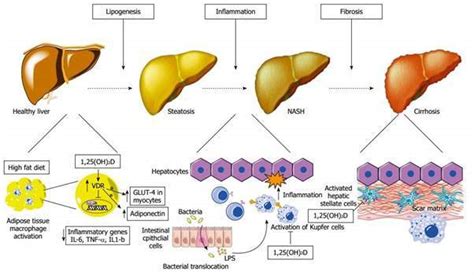 Omega 3 From Sacha Inchi Oil Reduces Fatty Liver Diseases