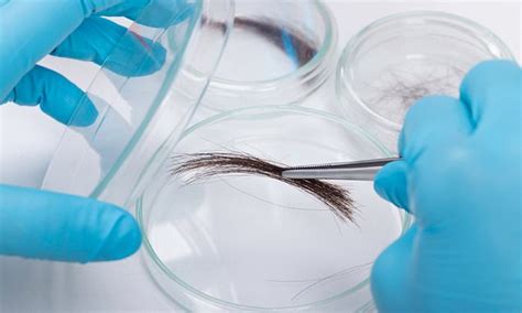 Check spelling or type a new query. Simple hair test 'could tell women how many eggs they have ...