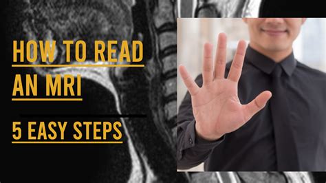 5 Easy Steps To Read A Spine Mri Video George Rajeesh