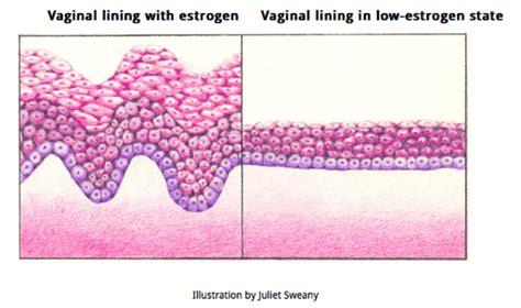 Swollen Vulva On One Side Swollen Vulva Causes Other Symptoms