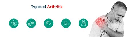 Recognize Types Of Arthritis Symptoms Causes And Management Strategies Ganesh Diagnostic