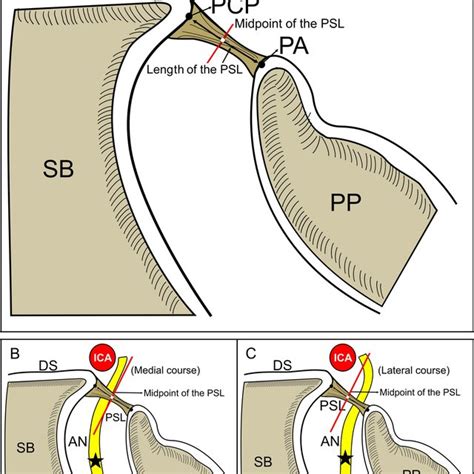 Schematic Drawing Of Postero Superior View Of The Clivus Bone
