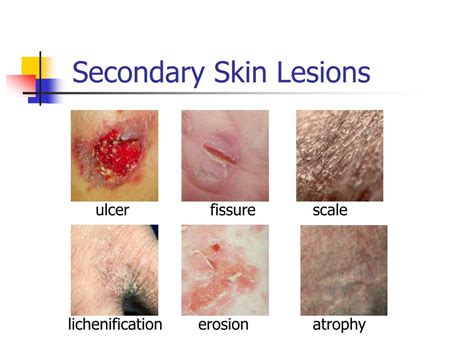 Ppt Non Infectious Skin Diseases Powerpoint Presentation Free