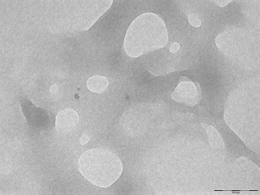 Transmission Electron Microscopy Image Of Propolis Loaded Niosomes