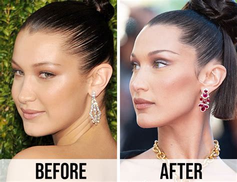 Bella Hadid Then And Now See How Much Her Face Has Changed Over The