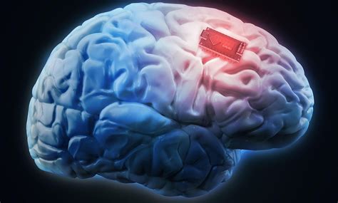 qanda the ethics of using brain implants to upgrade yourself human memory implants scientist