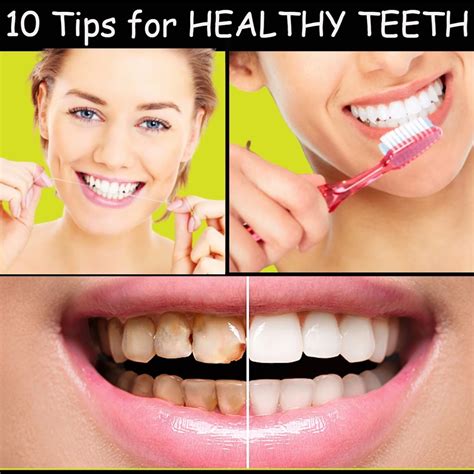 10 Tips For Healthy Teeth Who Likes Yellow And Bad Teeth Follow