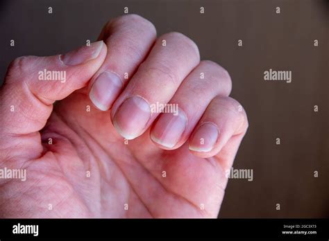 gros plan des ongles féminins après une mauvaise manucure sur fond marron ongles trop gros et