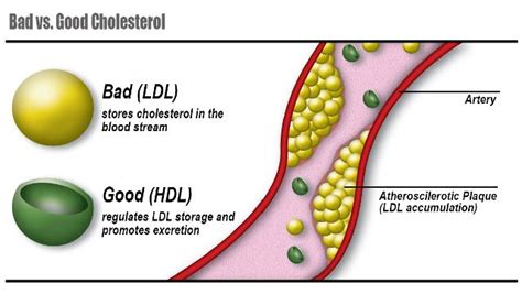 Hdl And Ldl Do You Know The Difference Kauvery Hospital