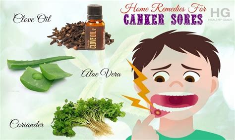 Duodenal ulcer, causes of ulcer, treatment of ulcer, prevention of ulcer, symptoms of ulcer, how to treat ulcer, what is ulcer, effects of ulcer. 20 Home Remedies For Canker Sores On Tongue, Gums And In ...