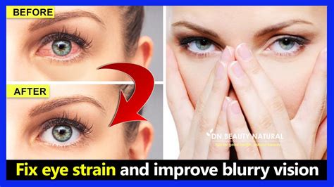 Best Eye Exercises How To Fix Digital Eye Strain Dry Eyes And Improve Blurry Vision Naturally