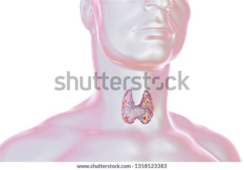 Thyroid Parathyroid Glands Human Body 3d Illustration De Stock