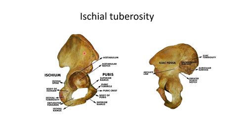 Ischial Tuberosity Youtube
