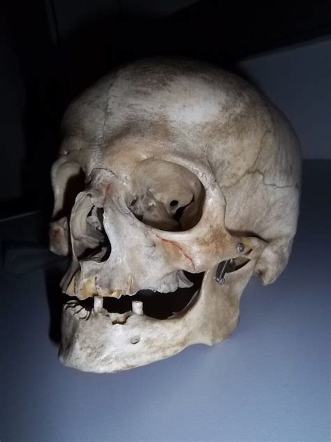 Real Human Skull Headshot Real Human Skull Skull Human Skull