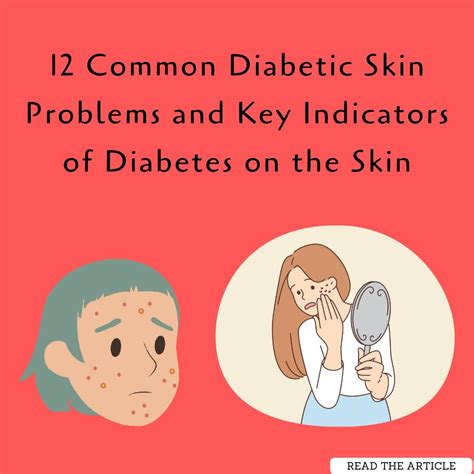 12 Common Diabetic Skin Problems And Key Indicators Of Diabetes On The