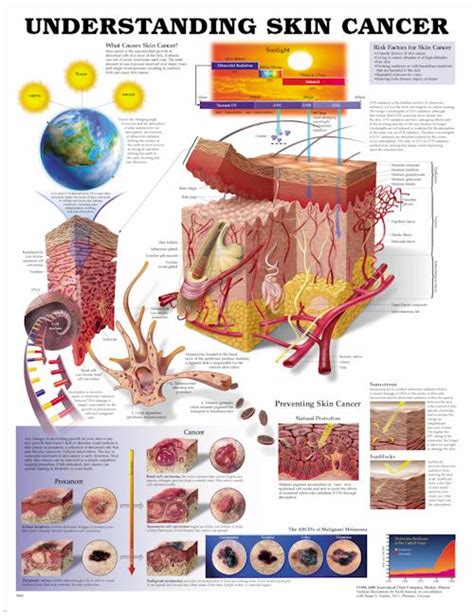 Anatomy Charts Posters Understanding Skin Cancer Anatomical Chart The