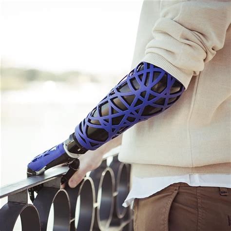 Unyq Launches Collection Of D Printed Prosthetic Upper Limb Covers Prosthetics Wearable Tech