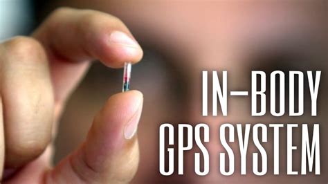 Why An In Body Gps Tracker Is Really Useful Remix In Body Gps Microchip Youtube