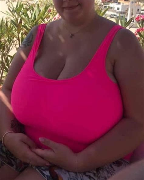 Nhs Turns Down Womans Plea To Reduce Her Four Stone Breasts