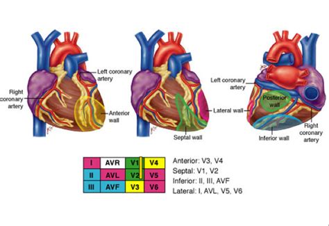 Coronary Arteries And Correlating Ecg Leads In Mi Cardiology Study