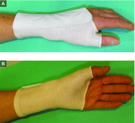 Orthèse de traumatologie main et poignet gibaud trauma poignet pouce. Orthèse poignet-pouce pour ténosynovite de De Quervain ...