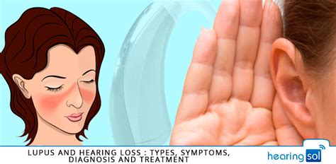 Lupus And Hearing Loss Types Symptoms And Best Treatment