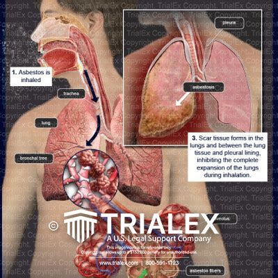 Upper Respiratory Tract Anatomy