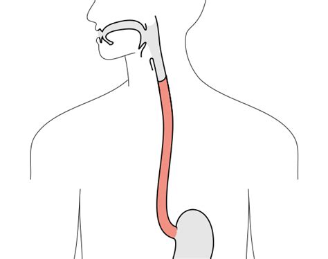 Esophageal Stricture — Symptoms And Treatment Medical Library
