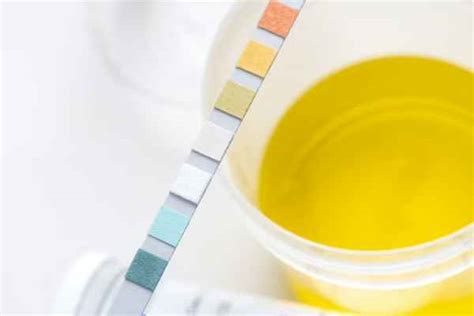 Liver Disease Urine Color What You Need To Know Tv Health