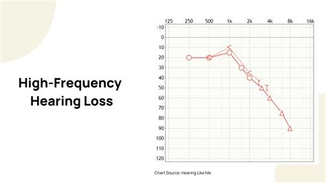 High Frequency Hearing Loss Causes Treatments Prevention