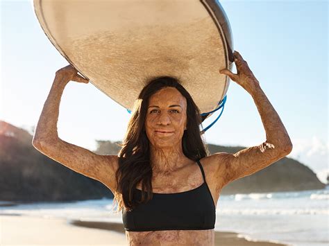 Turia Pitt On Family Her Happy Place And How She Stays Safe In The Sun