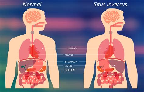 This tissue contains thousands of large spaces that fill with blood when the man is sexually aroused. El situs inversus es una condición congénita en la cual ...