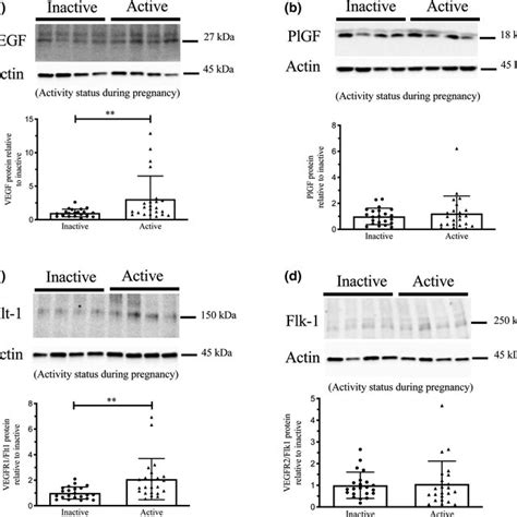 Expression Of Vegf Plgf Vegfr Flt And Vegfr Flk Protein By