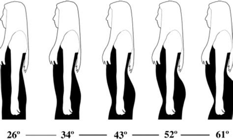 Men Like Women With Curved Spines As They Are Better At Food Foraging