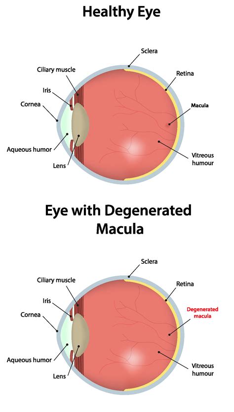Eyes And Vision As Related To Age Related Macular Degeneration Pictures