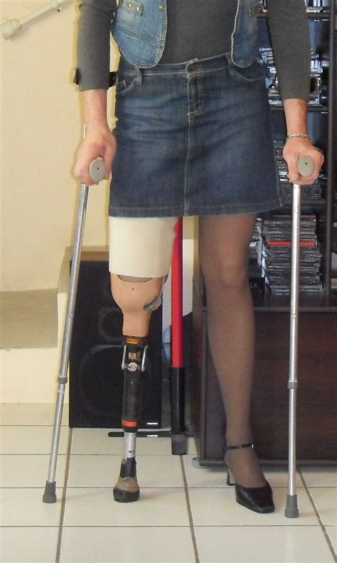 Flickriver Most Interesting Photos From Prosthetic Leg Devoteeadmirer