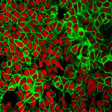 Human Colon Cancer Cells | Human colon cancer cells with the… | Flickr