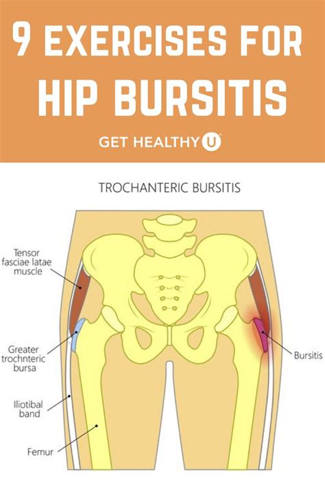 Best Exercises For Hip Bursitis Video Included Best Exercise For Hips Bursitis Hip Hip