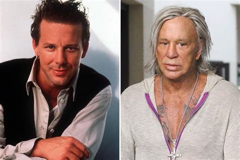 Mickey Rourke Les Chirurgies Esthétiques Quil A Subi
