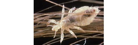 How To Get Rid Of Head Lice Diy Head Lice Control Products