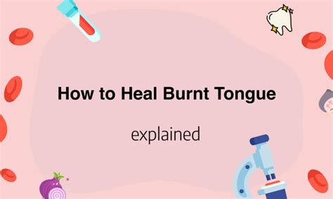 How To Heal Burnt Tongue Tips For Quick Relief