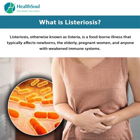 Listeriosis Symptoms And Treatment Healthsoul