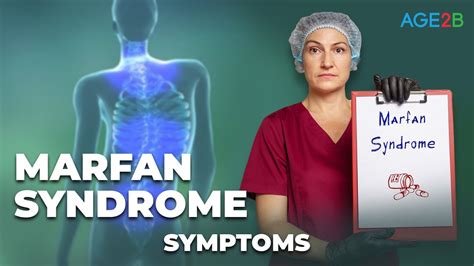 Marfan Syndrome Symptoms ข้อมูลทั้งหมดที่เกี่ยวข้องกับmarfan