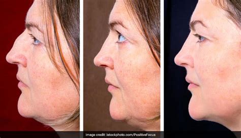 Slim Your Face Exercises Off 68