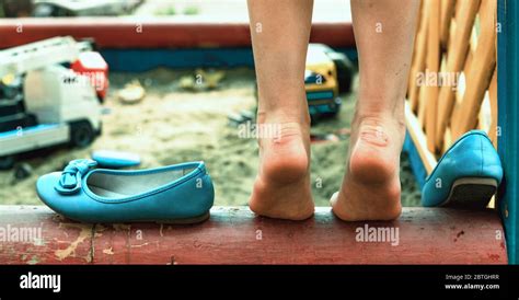 Das Mädchen Mit Schwielen Auf Den Fersen Ist Barfuß Stockfotografie Alamy