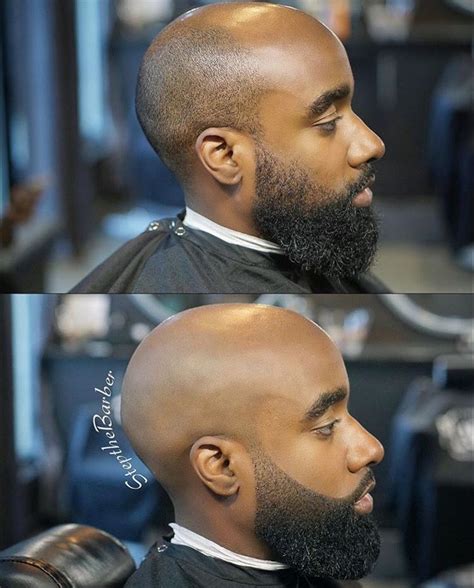 Favorite Hairstyle For Black Men Bald Spots
