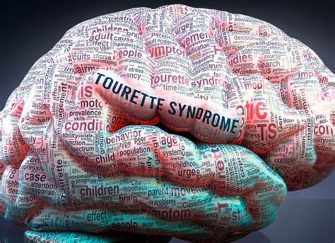 Síndrome de Tourette qué es y cómo son sus tics Salud